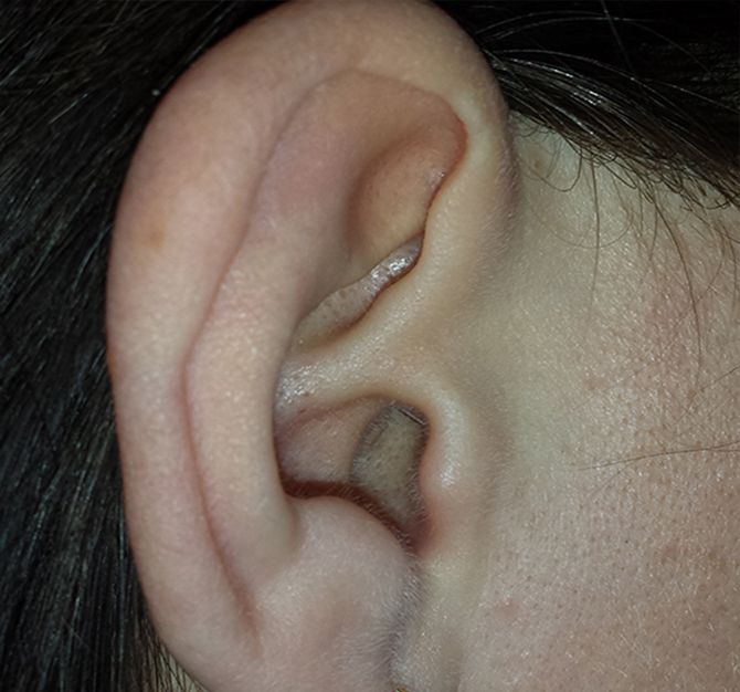 Au ajuns la spital din cauza căștilor magnetice cu ajutorul cărora au copiat la un examen