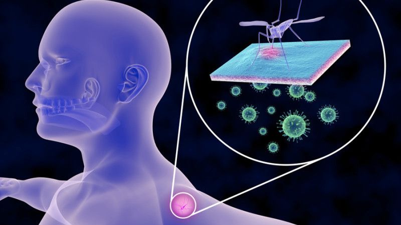 Pacienta diagnosticată cu virusul West Nile, la Terapie Intensivă