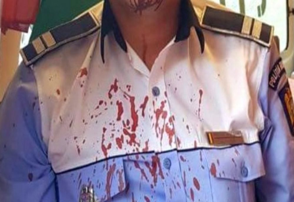 Scene teribile la Iași! Un bărbat și iubita lui au bătut un polițist și un jandarm