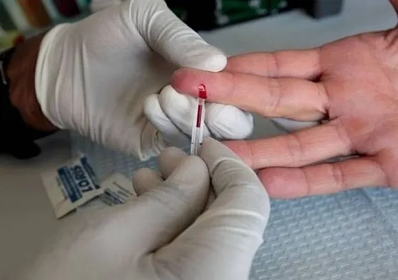 testare hepatita
