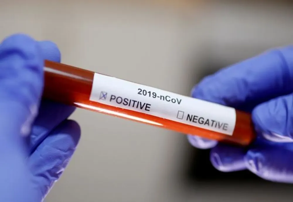 Câte persoane au fost confirmate ca fiind infectate cu coronavirus în Iași