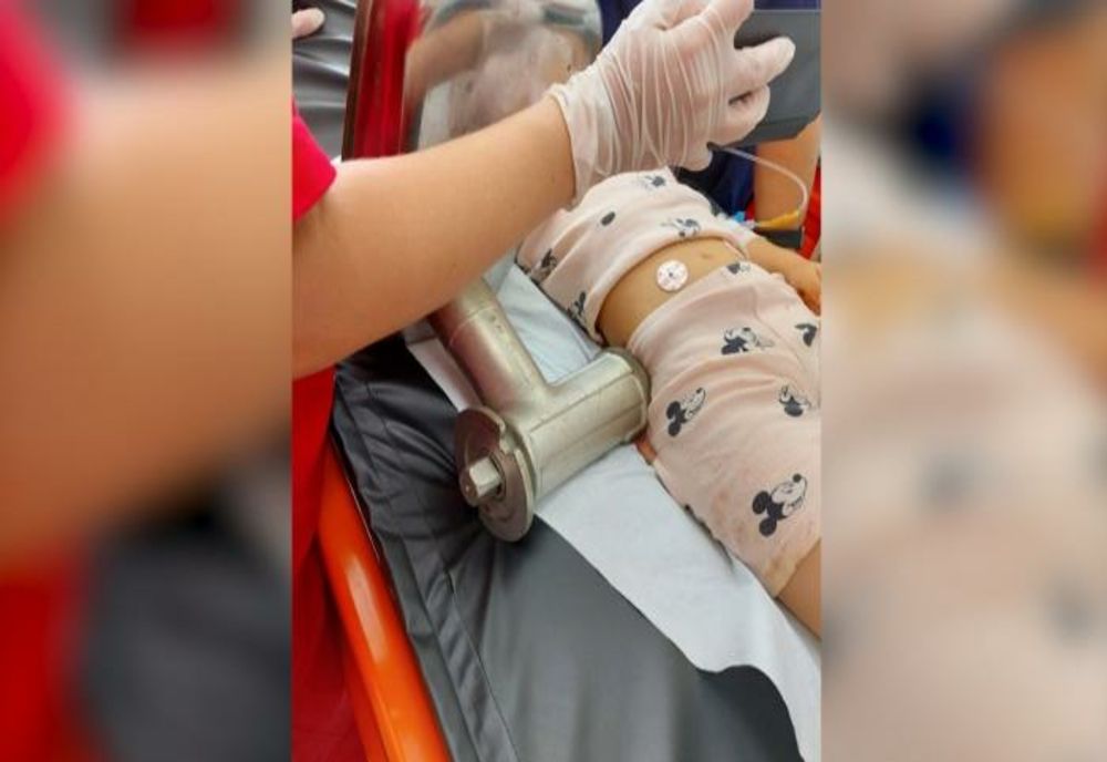 Medicii ieșeni, ajutaţi de mecanici și pompieri pentru a demonta maşina de tocat care i-a prins mâna unei fetiţe de 4 ani