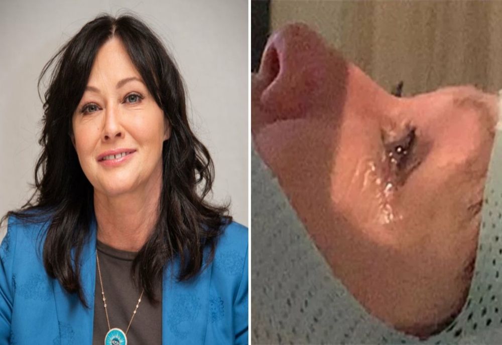 „Cancerul a ajuns la creier”. Cât mai are de trăit Shannen Doherty
