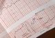 Noua BOALĂ a românilor: tot mai multe persoane ajung la spital. Cum se MANIFESTĂ și care este PRINCIPALA CAUZĂ